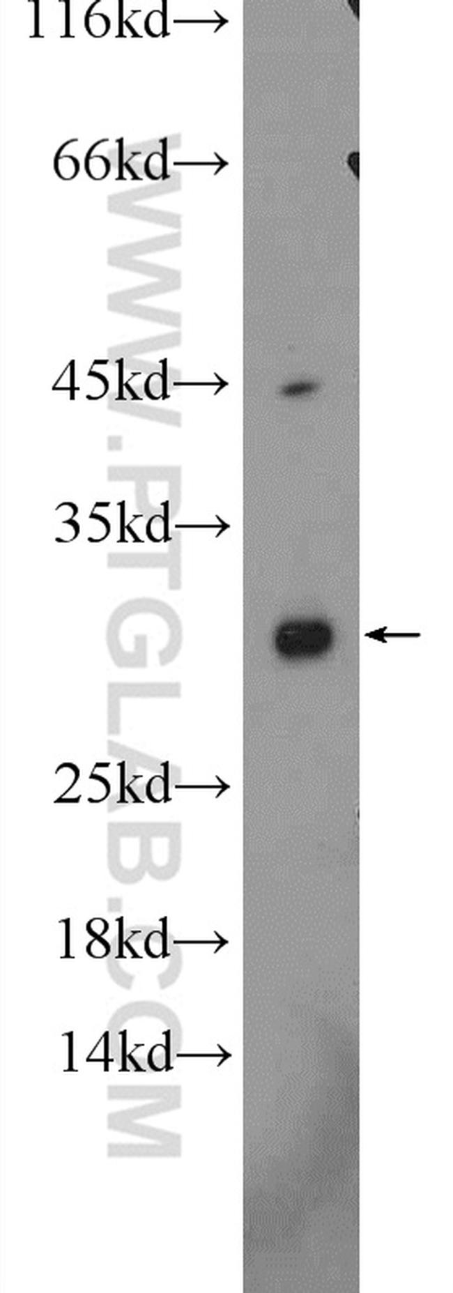 ANKRD7 Antibody in Western Blot (WB)