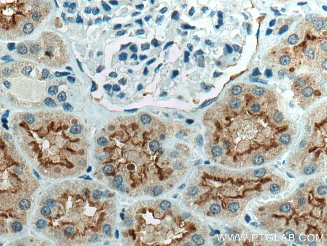 ACE2 Antibody in Immunohistochemistry (Paraffin) (IHC (P))