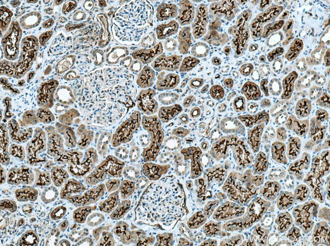 ACE2 Antibody in Immunohistochemistry (Paraffin) (IHC (P))