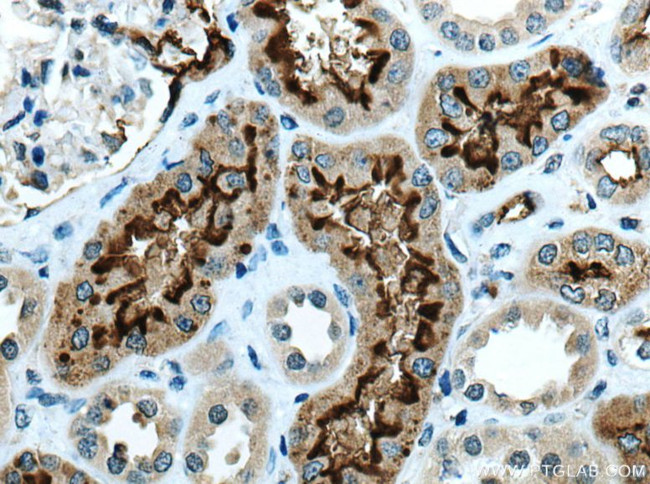 ACE2 Antibody in Immunohistochemistry (Paraffin) (IHC (P))