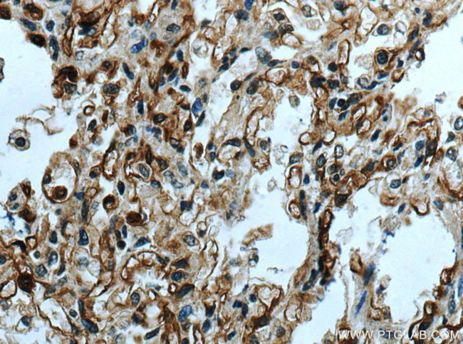 ACE2 Antibody in Immunohistochemistry (Paraffin) (IHC (P))