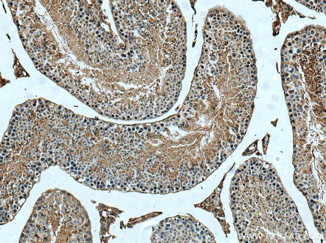 ACE2 Antibody in Immunohistochemistry (Paraffin) (IHC (P))