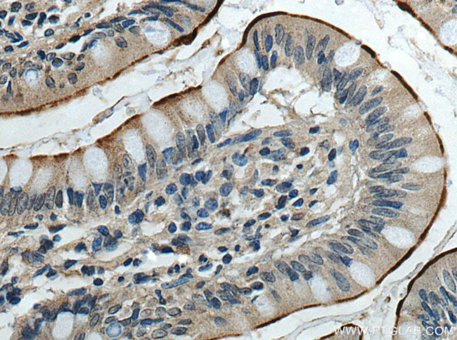 ACE2 Antibody in Immunohistochemistry (Paraffin) (IHC (P))