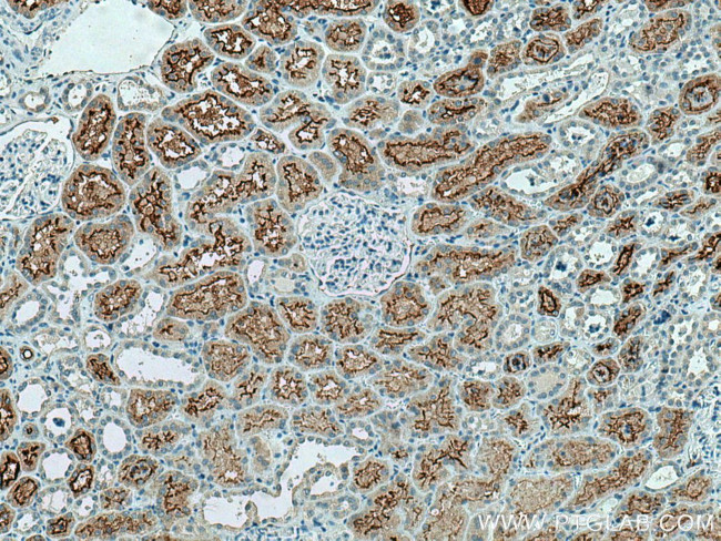 ACE2 Antibody in Immunohistochemistry (Paraffin) (IHC (P))