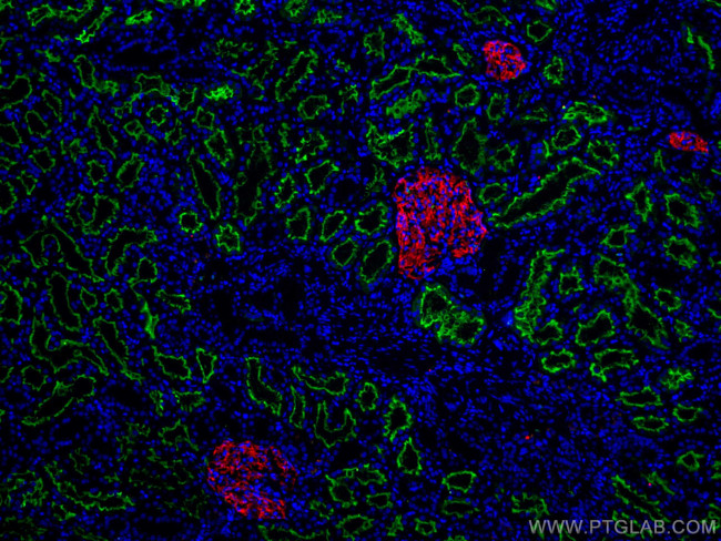 ACE2 Antibody in Immunohistochemistry (PFA fixed) (IHC (PFA))