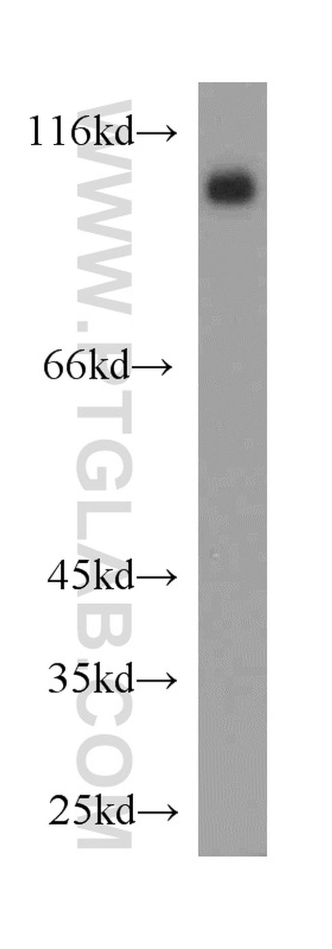 ACE2 Antibody in Western Blot (WB)