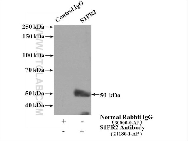 S1PR2 Antibody in Immunoprecipitation (IP)