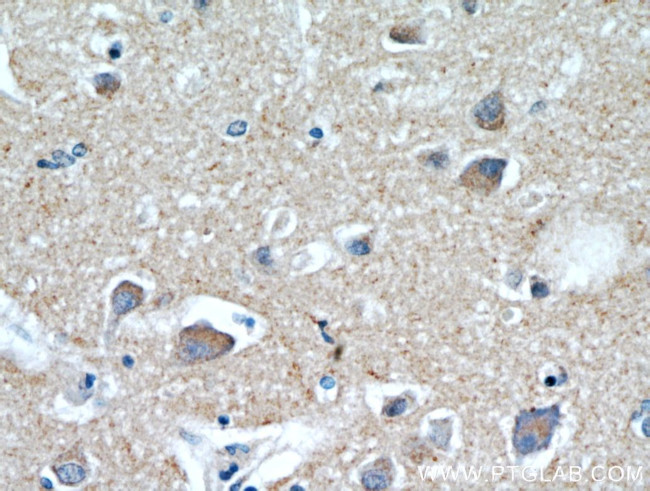 HAPLN4 Antibody in Immunohistochemistry (Paraffin) (IHC (P))