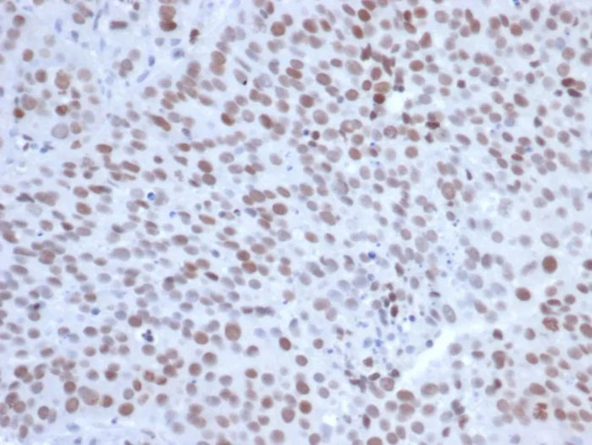 EZH2/KMT6 Antibody in Immunohistochemistry (Paraffin) (IHC (P))