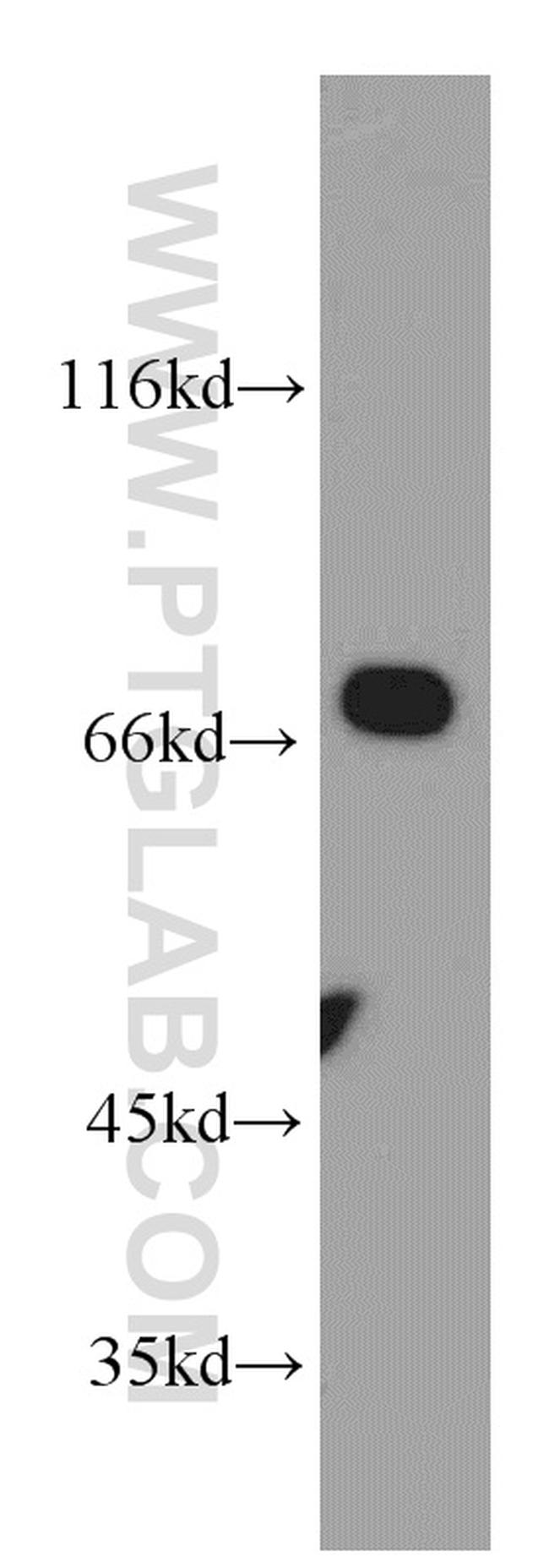 Arp5/ACTR5 Antibody in Western Blot (WB)