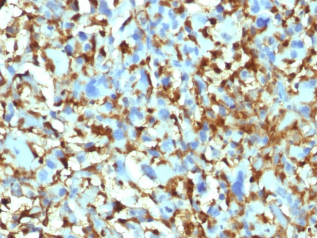 Factor XIIIa (Coagulation Factor XIIIA Chain) Antibody in Immunohistochemistry (Paraffin) (IHC (P))