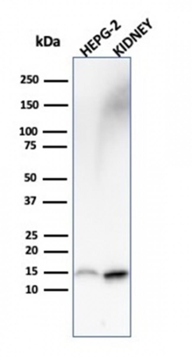 Fatty Acid Binding Protein (Liver)/FABP1 Monoclonal Antibody (FABP1 ...