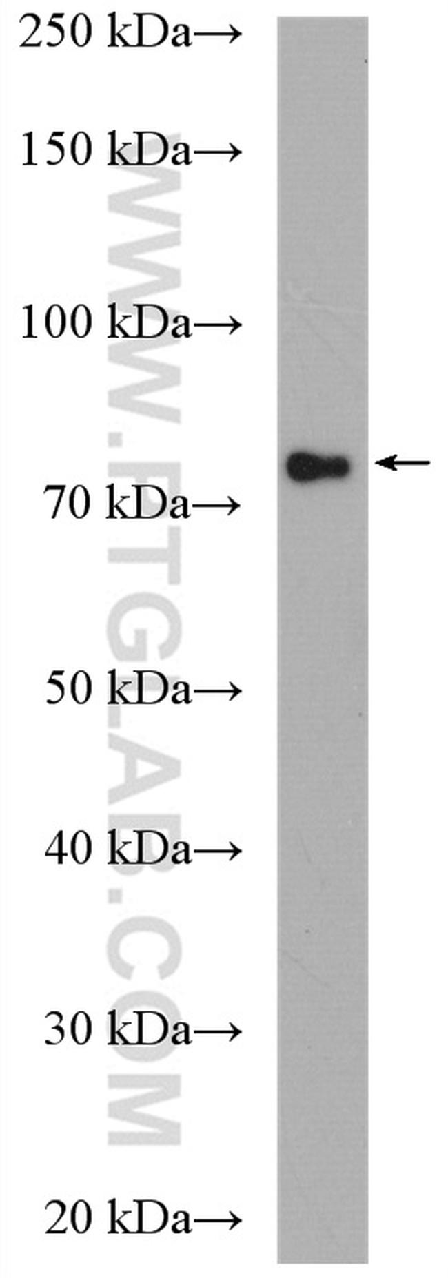 ZNF132 Antibody in Western Blot (WB)