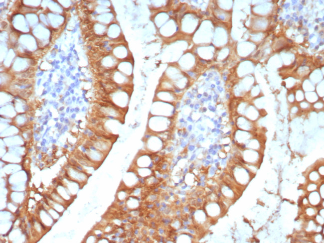 FABP2 (Marker of Metastatic Potential in Colorectal Cancer) Antibody in Immunohistochemistry (Paraffin) (IHC (P))