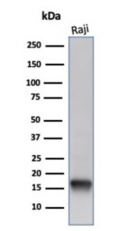 FABP5 (Marker of Metastatic Potential in Colorectal Cancer) Antibody in Western Blot (WB)