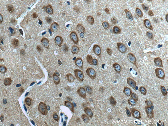 L-VOCC Antibody in Immunohistochemistry (Paraffin) (IHC (P))