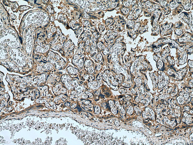 Collagen Type XI Antibody in Immunohistochemistry (Paraffin) (IHC (P))