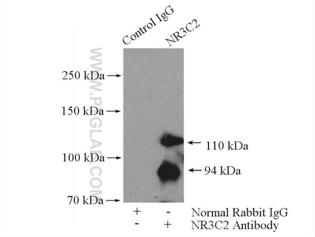 NR3C2 Antibody in Immunoprecipitation (IP)