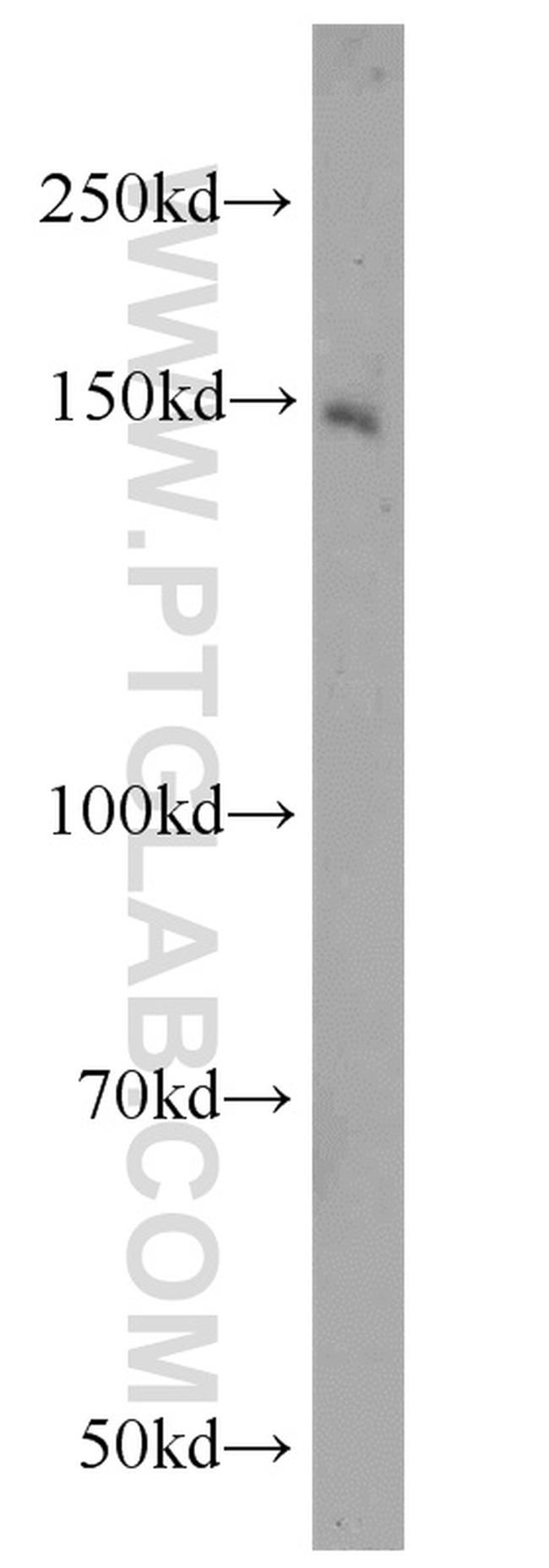 ZNF541 Antibody in Western Blot (WB)