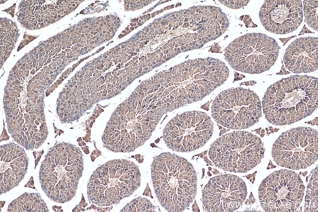 USH1G Antibody in Immunohistochemistry (Paraffin) (IHC (P))