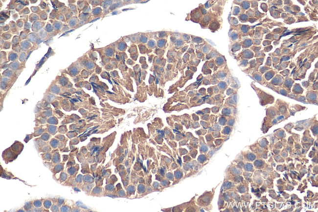 USH1G Antibody in Immunohistochemistry (Paraffin) (IHC (P))