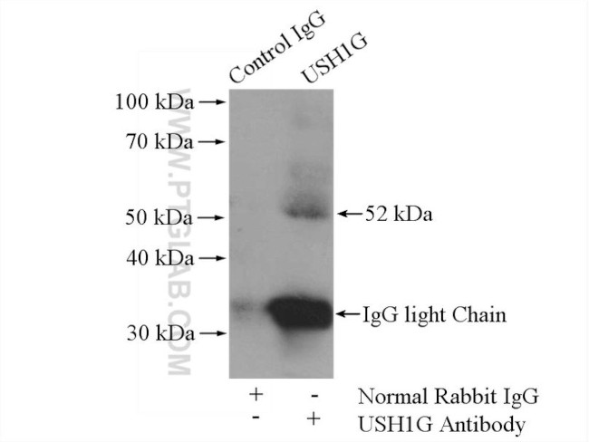 USH1G Antibody in Immunoprecipitation (IP)