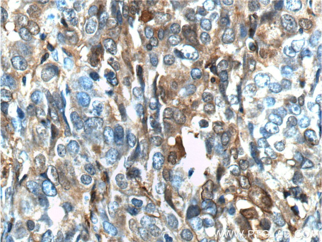 Annexin A1 Antibody in Immunohistochemistry (Paraffin) (IHC (P))