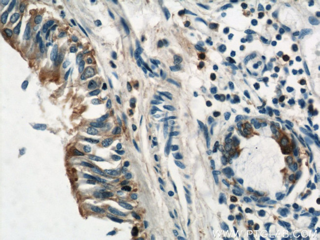 Annexin A1 Antibody in Immunohistochemistry (Paraffin) (IHC (P))