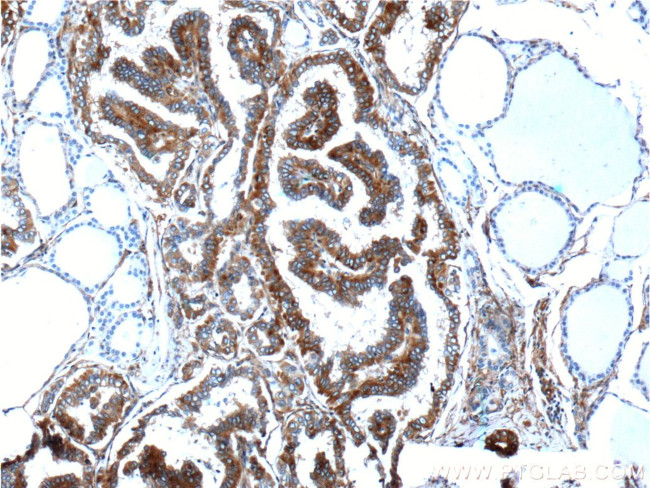 PKC alpha Antibody in Immunohistochemistry (Paraffin) (IHC (P))