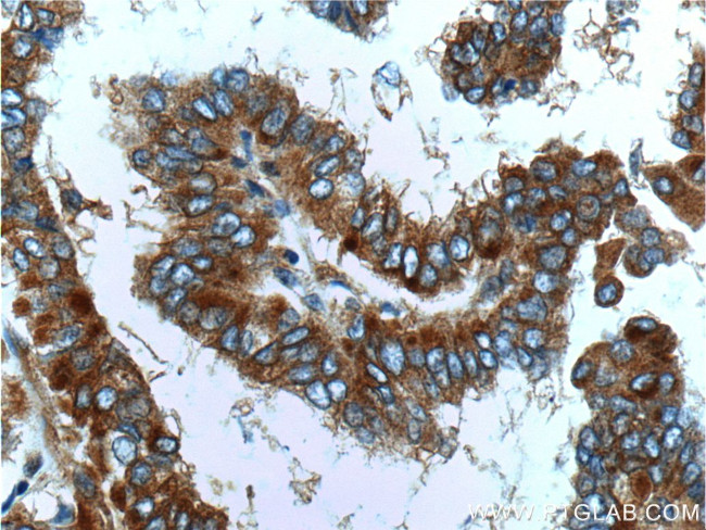 PKC alpha Antibody in Immunohistochemistry (Paraffin) (IHC (P))