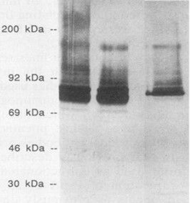 Streptococcus pneumoniae Antibody in Western Blot (WB)