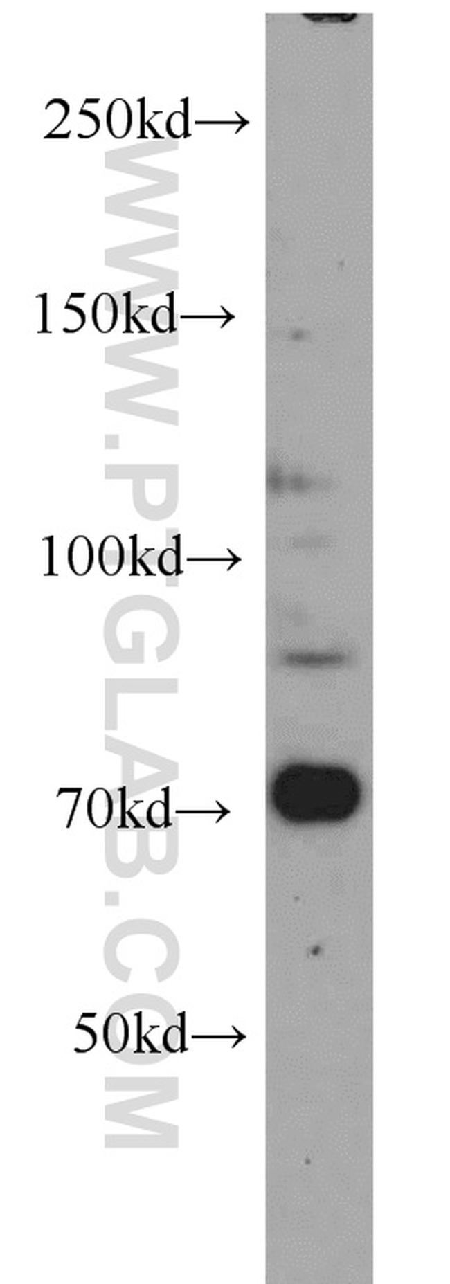 androgen receptor Antibody in Western Blot (WB)