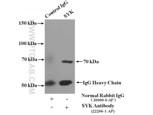 SYK Antibody in Immunoprecipitation (IP)