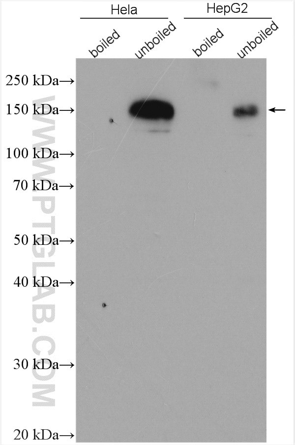 P glycoprotein Antibody in Western Blot (WB)