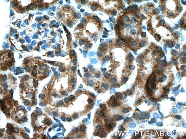 P glycoprotein Antibody in Immunohistochemistry (Paraffin) (IHC (P))