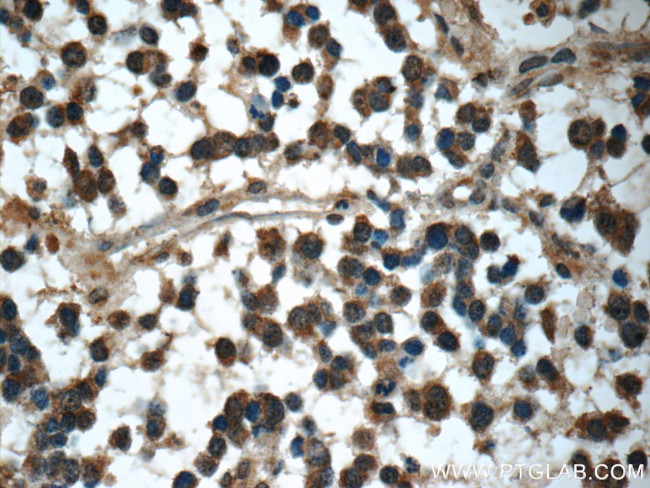 C9orf72 Antibody in Immunohistochemistry (Paraffin) (IHC (P))