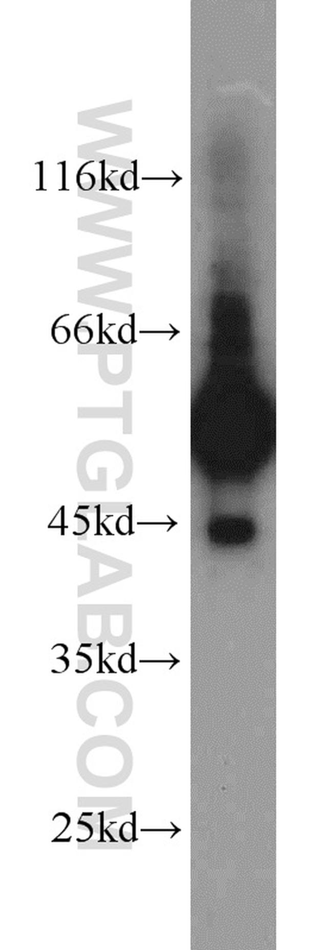 C9orf72 Antibody in Western Blot (WB)