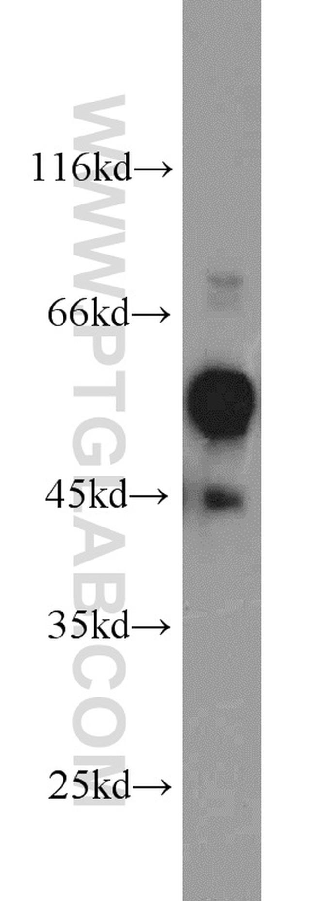 C9orf72 Antibody in Western Blot (WB)