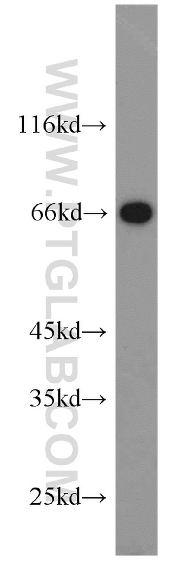 HSF4 Antibody in Western Blot (WB)