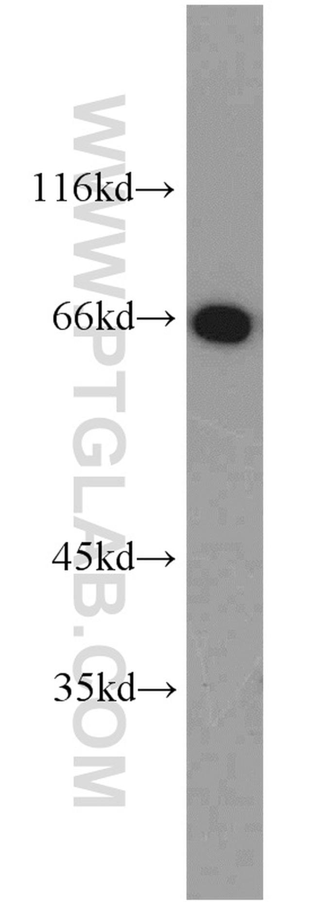 HSF4 Antibody in Western Blot (WB)