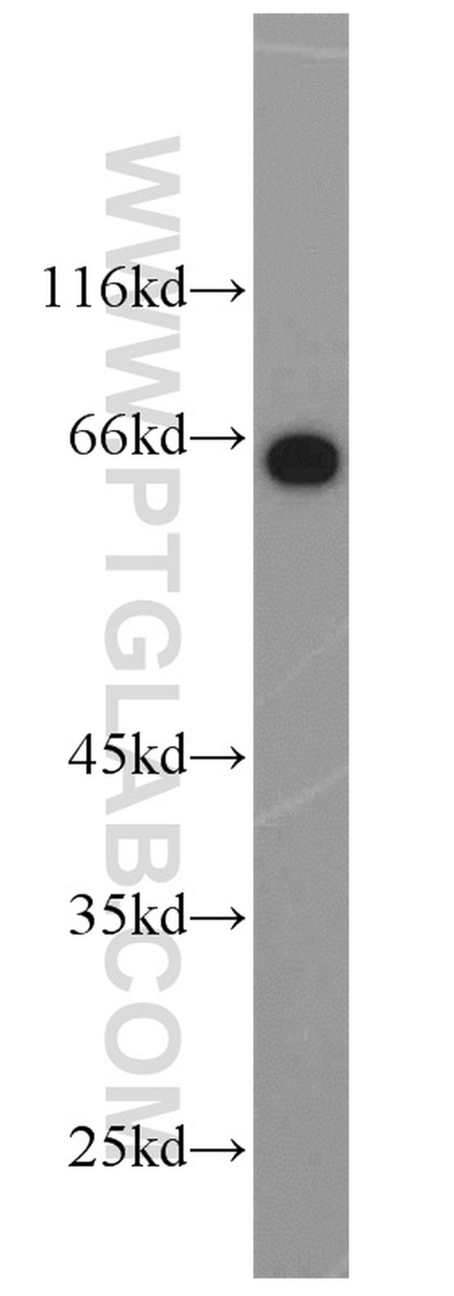 HSF4 Antibody in Western Blot (WB)