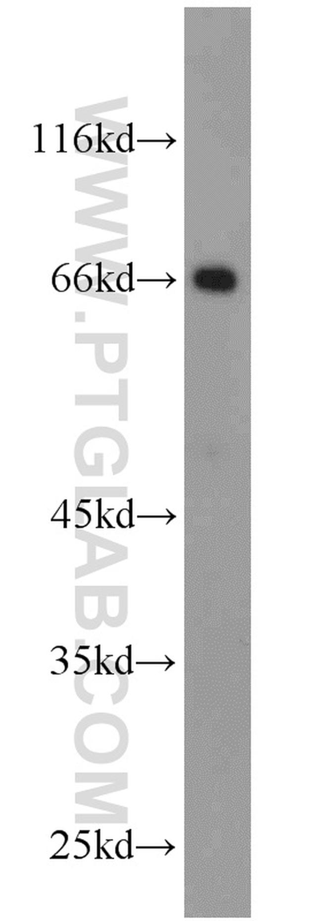 HSF4 Antibody in Western Blot (WB)