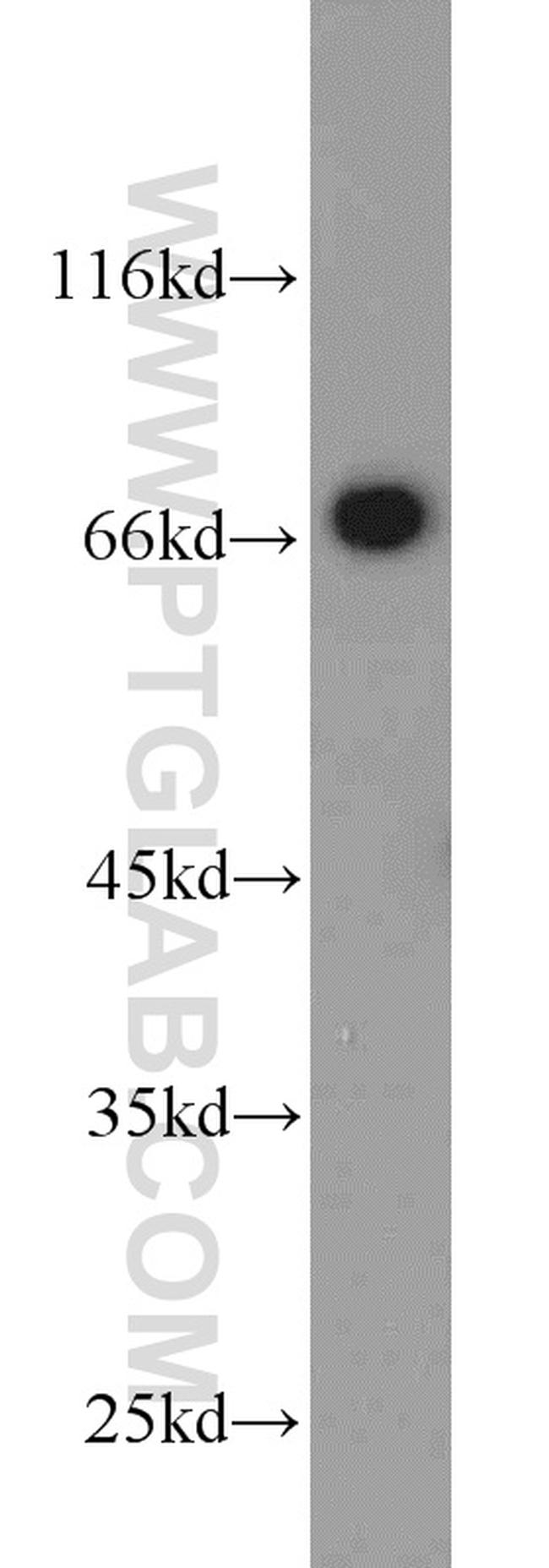 HSF4 Antibody in Western Blot (WB)