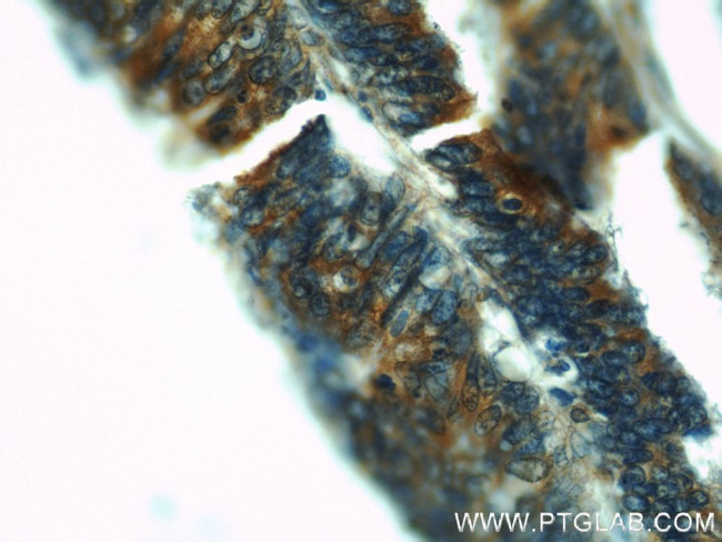 Osteopontin Antibody in Immunohistochemistry (Paraffin) (IHC (P))