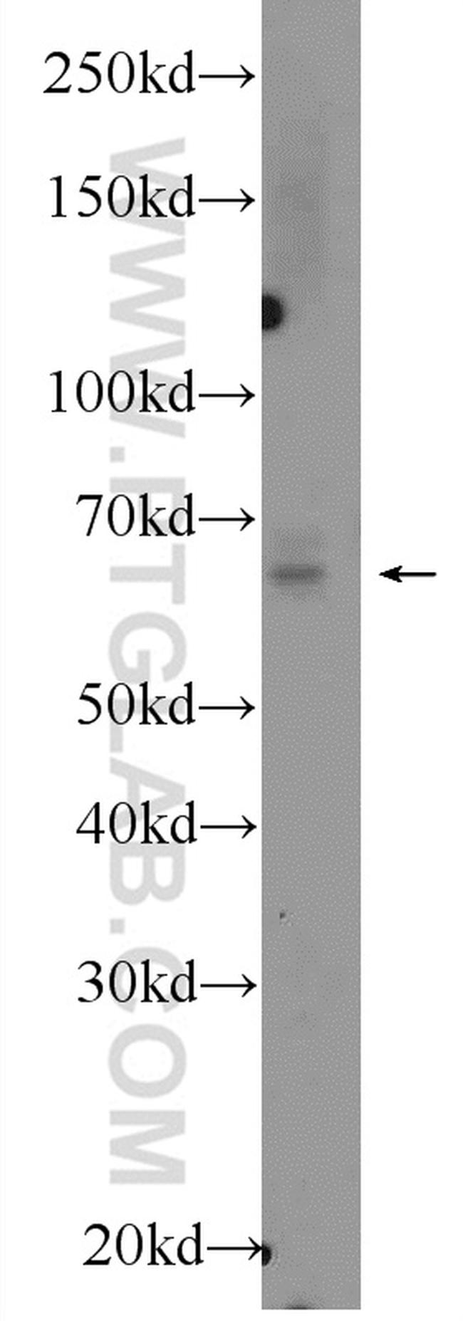 Osteopontin Antibody in Western Blot (WB)