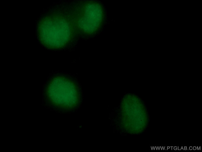 PARP1 Antibody in Immunocytochemistry (ICC/IF)