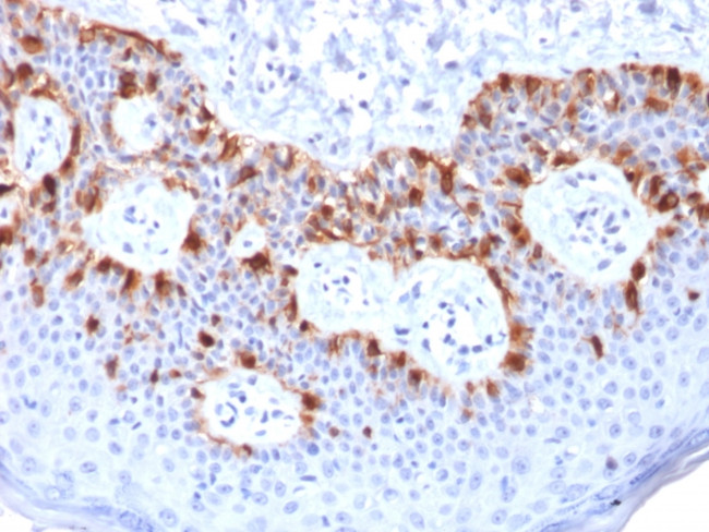 MART-1/Melan-A/MLANA Antibody in Immunohistochemistry (Paraffin) (IHC (P))