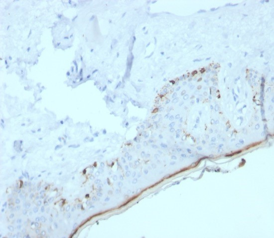 MART-1/Melan-A/MLANA (Melanoma Marker) Antibody in Immunohistochemistry (Paraffin) (IHC (P))