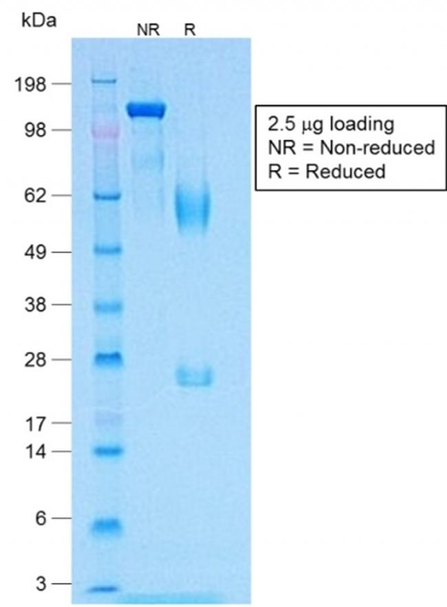 MART-1/Melan-A/MLANA Antibody in SDS-PAGE (SDS-PAGE)