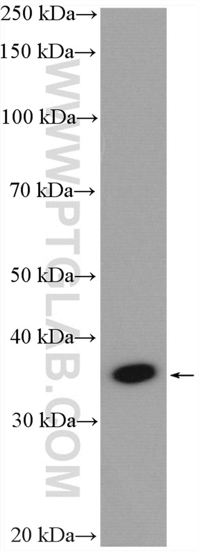 MYD88 Antibody in Western Blot (WB)